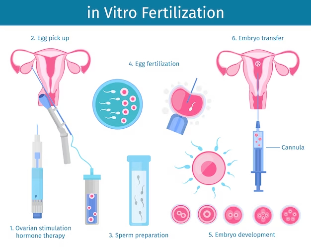 Intra- Uterine insemination